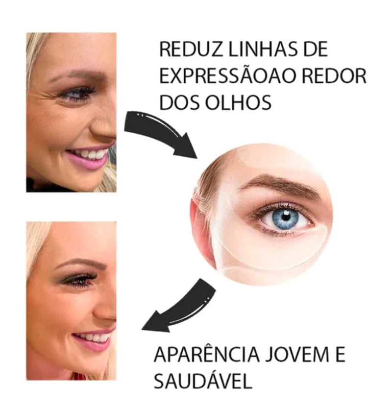 Nature Botox - Livre de rugas e linhas de expressões!